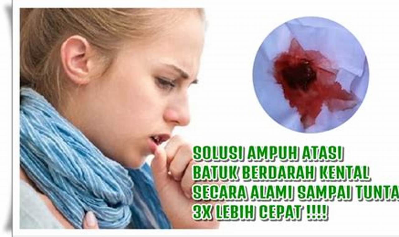 cara mengatasi batuk berdarah